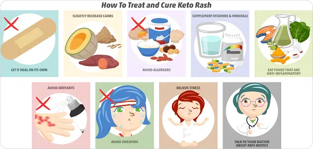 علاج الكيتو راش بأفضل 6 طرق فعالة